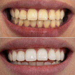 chewral review fr 13